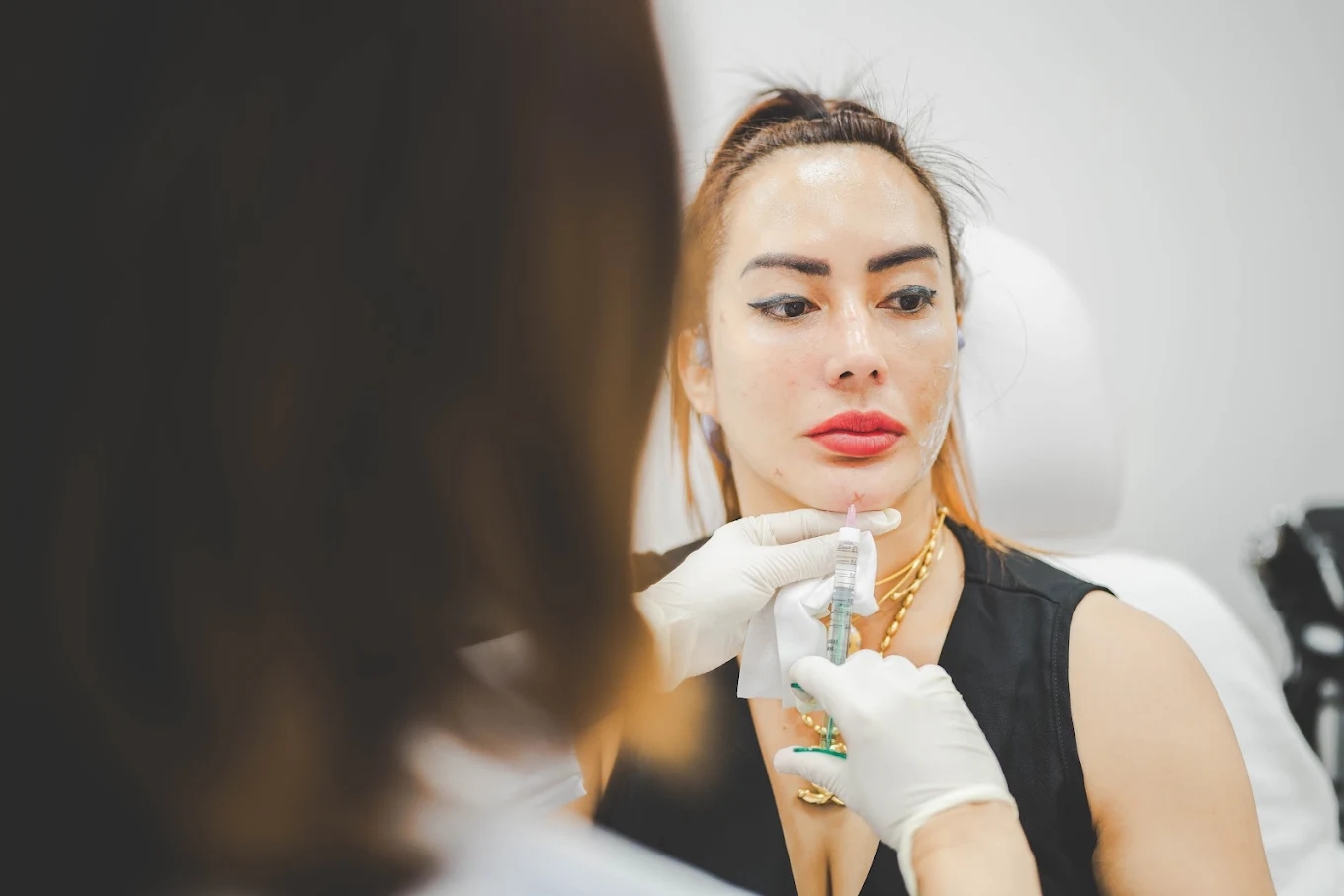 Filler Injection Treatment